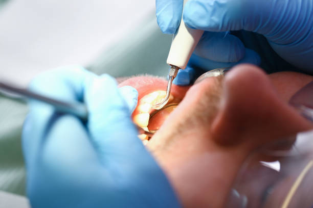 Best Emergency Dental Care for Broken or Chipped Teeth in Jay, OK